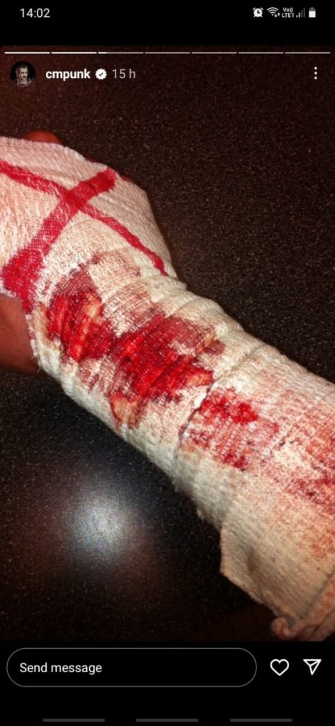 CM Punk’s cryptic post amid rumors of his WWE return  