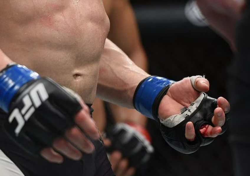 List of moves that are illegal in MMA  