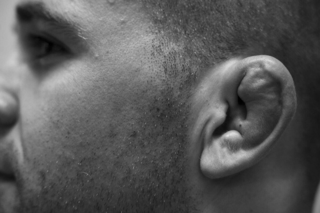 Cauliflower Ears: What is it & Why It Occurs To Fighters  