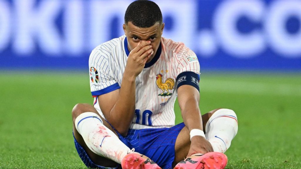Kylian Mbappe के नाक में लगी चोट, ट्विटर पर फैंस से मांगा मास्क के लिए आइडिया  