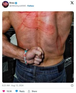 Drew McIntyre shares photo of his scars caused by CM Punk's belt whipping  