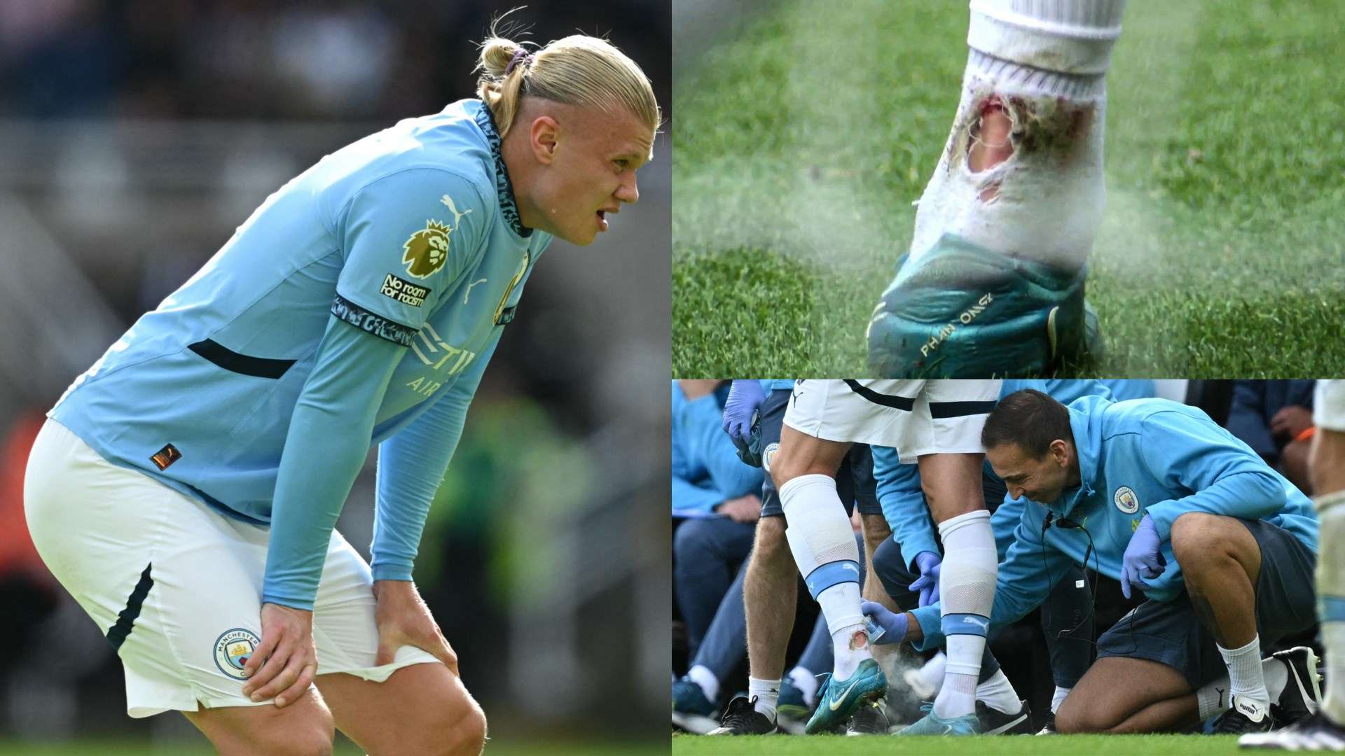 Haaland left bloodied & with torn sock in Newcastle clash  