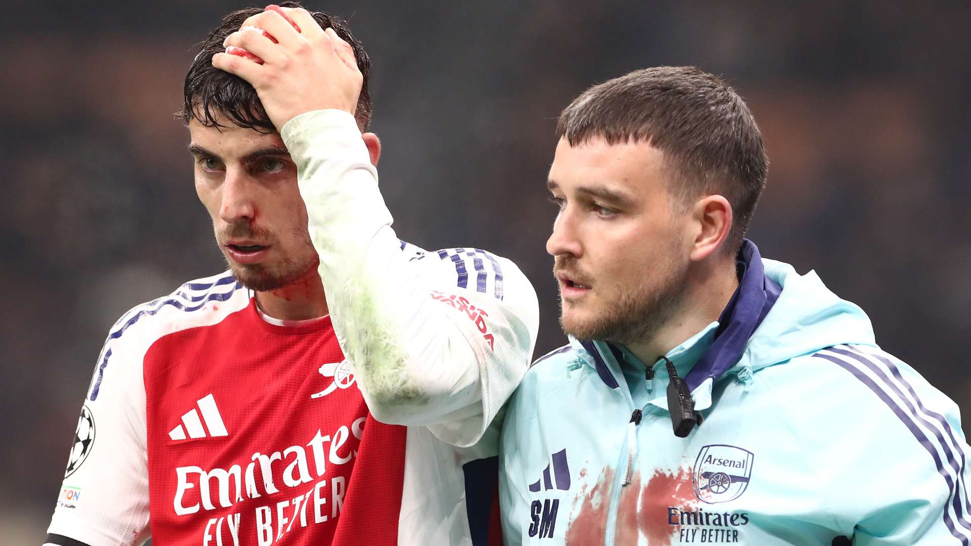 Arsenal issue Havertz update after nasty head injury  