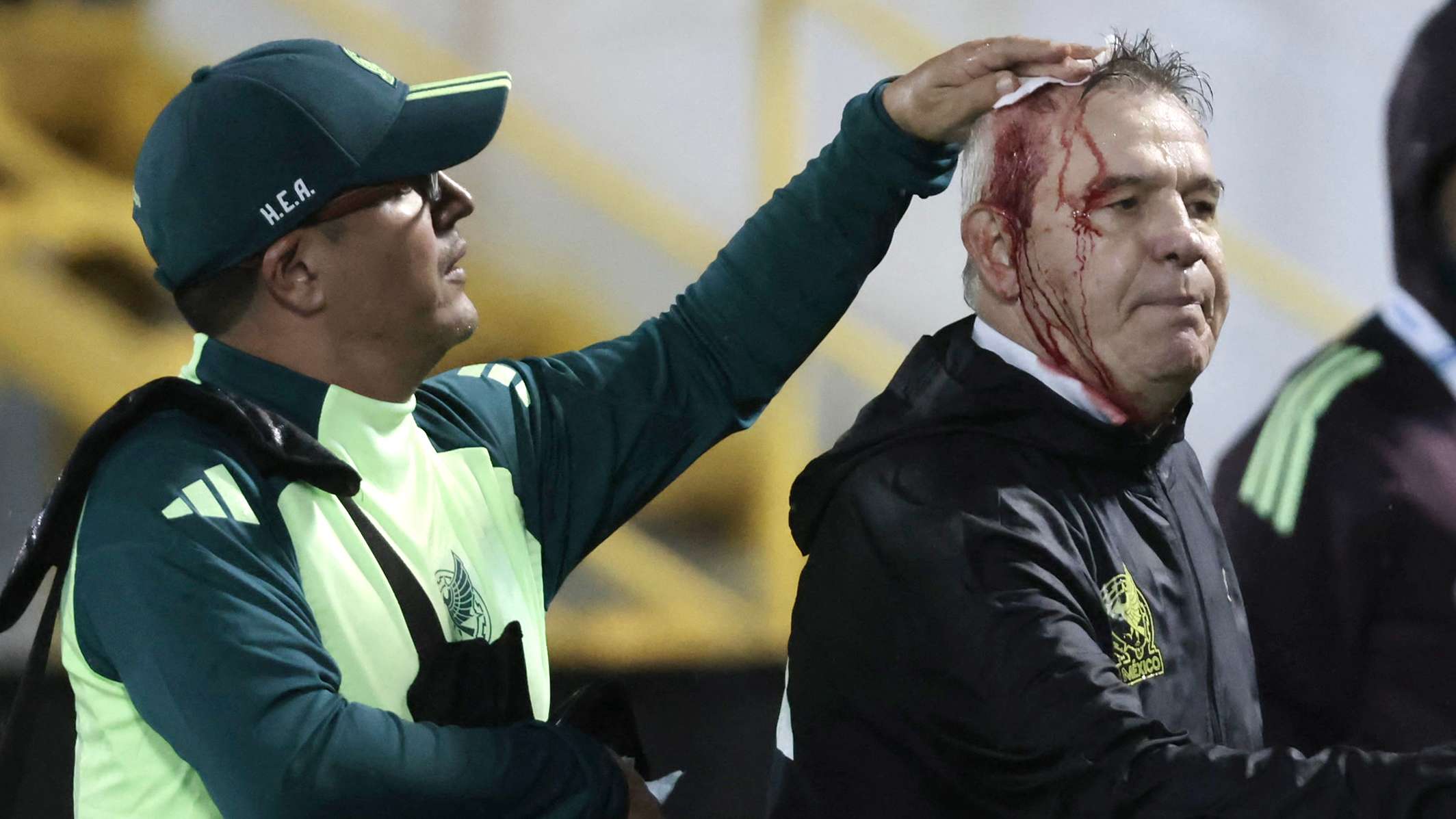 Mexico coach blamed by Honduras FA for being struck by missile  