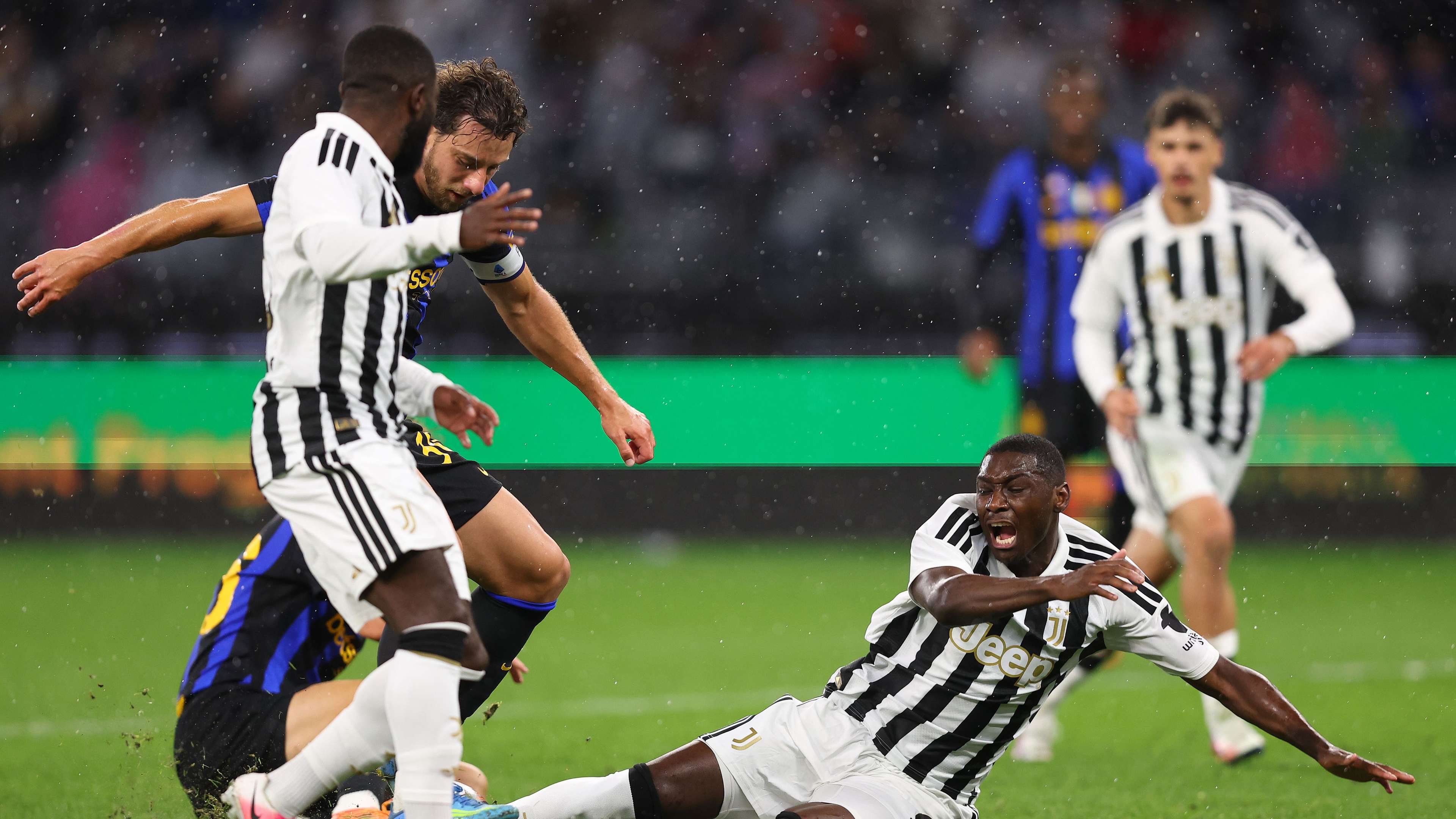 Official statement: urgent surgery for Juventus star after suffering a broken hand  