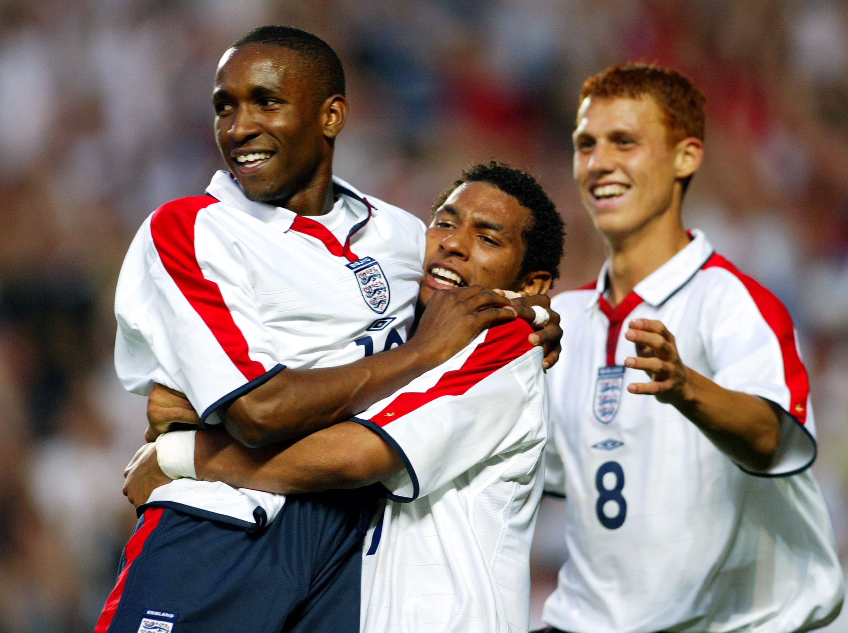 Fears for Jermaine Pennant: former Liverpool player attacked by dog, needs 50 stitches in his leg  
